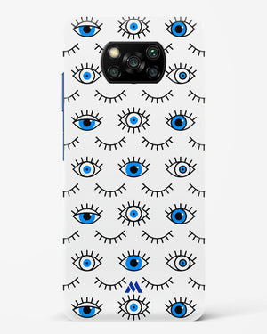 Eyes Wide Shut Hard Case Phone Cover-(Xiaomi)