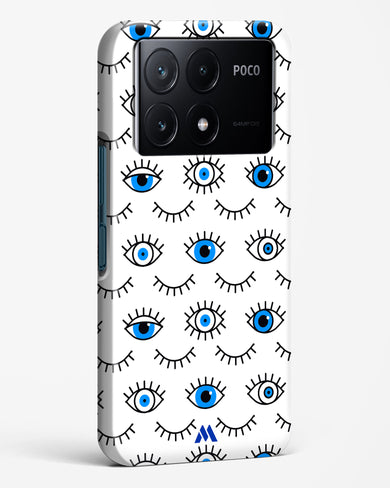 Eyes Wide Shut Hard Case Phone Cover (Xiaomi)