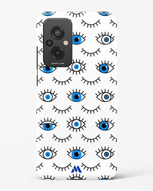 Eyes Wide Shut Hard Case Phone Cover (Xiaomi)