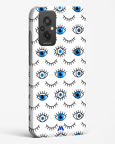 Eyes Wide Shut Hard Case Phone Cover (Xiaomi)