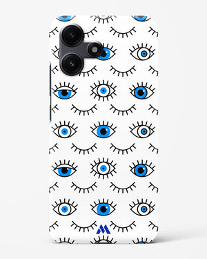 Eyes Wide Shut Hard Case Phone Cover (Xiaomi)