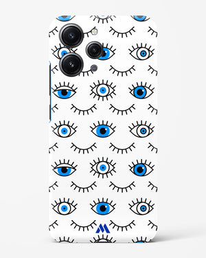 Eyes Wide Shut Hard Case Phone Cover (Xiaomi)