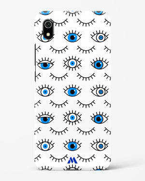 Eyes Wide Shut Hard Case Phone Cover-(Xiaomi)