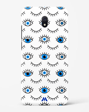 Eyes Wide Shut Hard Case Phone Cover (Xiaomi)