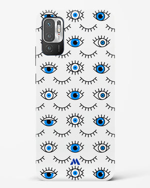 Eyes Wide Shut Hard Case Phone Cover (Xiaomi)