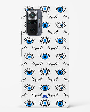 Eyes Wide Shut Hard Case Phone Cover (Xiaomi)