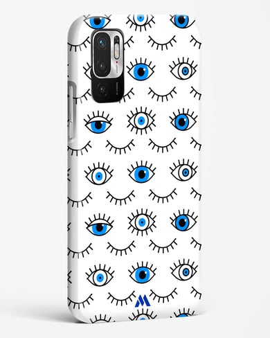 Eyes Wide Shut Hard Case Phone Cover-(Xiaomi)