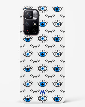 Eyes Wide Shut Hard Case Phone Cover-(Xiaomi)