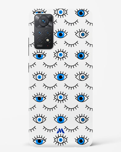 Eyes Wide Shut Hard Case Phone Cover-(Xiaomi)