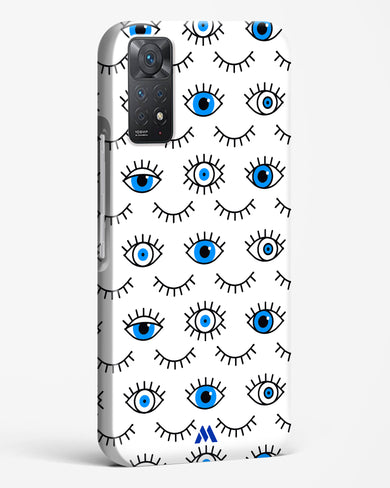 Eyes Wide Shut Hard Case Phone Cover-(Xiaomi)