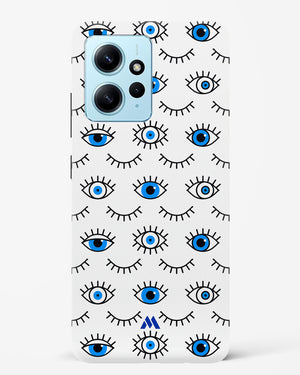 Eyes Wide Shut Hard Case Phone Cover (Xiaomi)