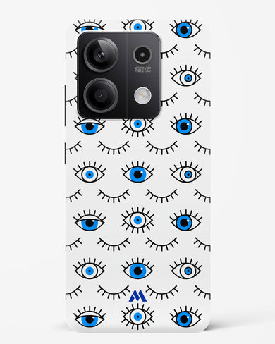 Eyes Wide Shut Hard Case Phone Cover (Xiaomi)