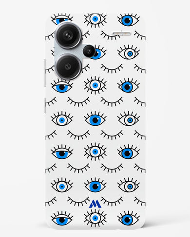 Eyes Wide Shut Hard Case Phone Cover (Xiaomi)