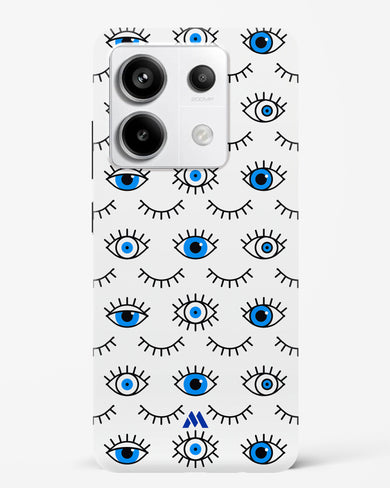 Eyes Wide Shut Hard Case Phone Cover (Xiaomi)