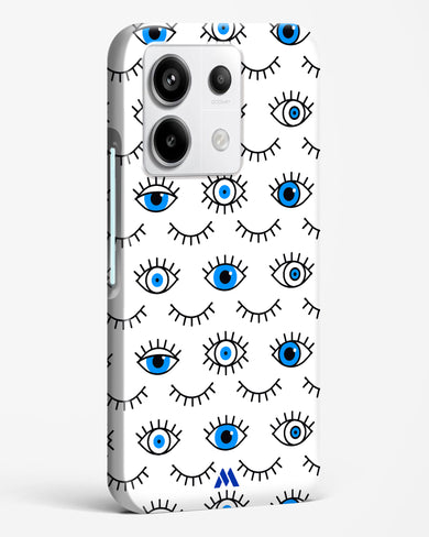 Eyes Wide Shut Hard Case Phone Cover (Xiaomi)