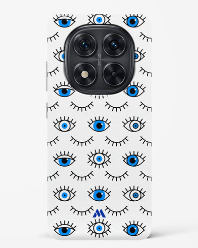 Eyes Wide Shut Hard Case Phone Cover (Xiaomi)