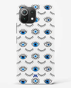 Eyes Wide Shut Hard Case Phone Cover-(Xiaomi)