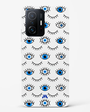 Eyes Wide Shut Hard Case Phone Cover-(Xiaomi)