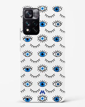 Eyes Wide Shut Hard Case Phone Cover-(Xiaomi)