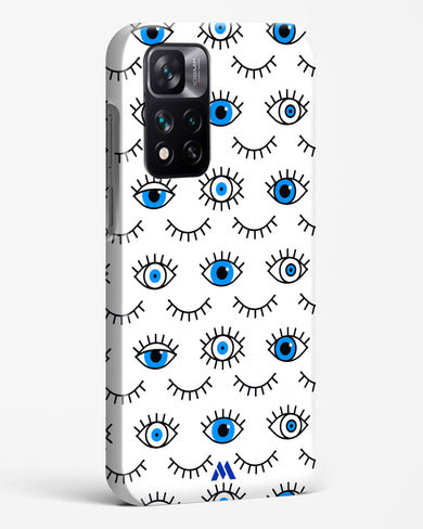 Eyes Wide Shut Hard Case Phone Cover-(Xiaomi)