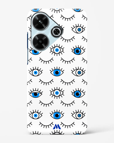 Eyes Wide Shut Hard Case Phone Cover (Xiaomi)