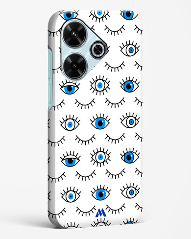 Eyes Wide Shut Hard Case Phone Cover (Xiaomi)