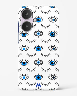 Eyes Wide Shut Hard Case Phone Cover (Xiaomi)