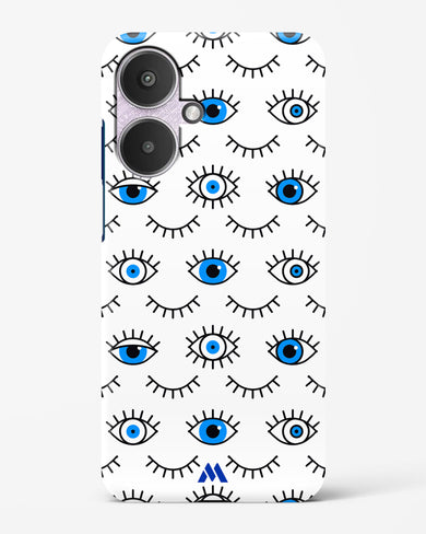 Eyes Wide Shut Hard Case Phone Cover (Xiaomi)