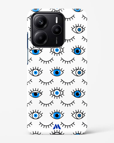 Eyes Wide Shut Hard Case Phone Cover (Xiaomi)