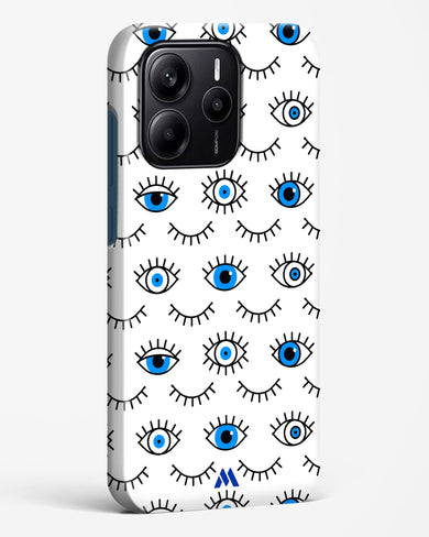 Eyes Wide Shut Hard Case Phone Cover (Xiaomi)
