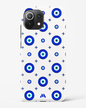 Evil Eye Array Hard Case Phone Cover (Xiaomi)