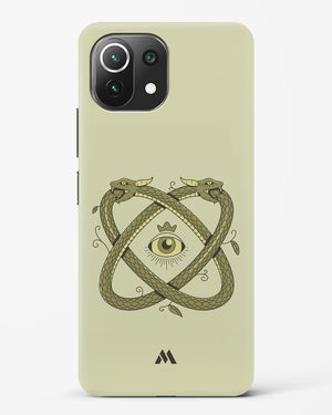 Serpent Sight Hard Case Phone Cover-(Xiaomi)