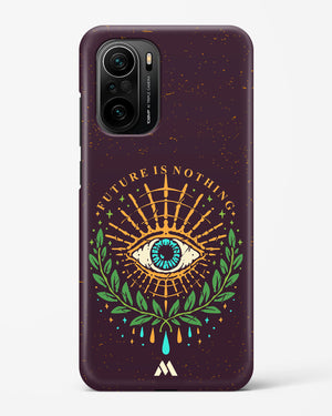 Glance of Destiny Hard Case Phone Cover (Xiaomi)