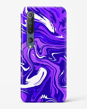 Cobalt Chroma Hard Case Phone Cover-(Xiaomi)