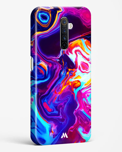 Radiant Vortex Hard Case Phone Cover (Realme)