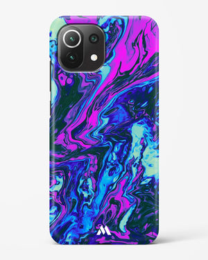 Marine Medley Hard Case Phone Cover (Xiaomi)