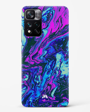 Marine Medley Hard Case Phone Cover (Xiaomi)