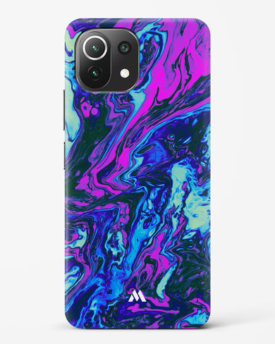 Marine Medley Hard Case Phone Cover (Xiaomi)