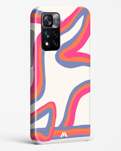 Pastel Harmony Hard Case Phone Cover-(Xiaomi)