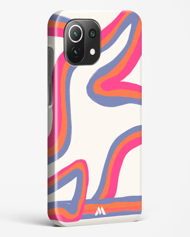 Pastel Harmony Hard Case Phone Cover (Xiaomi)