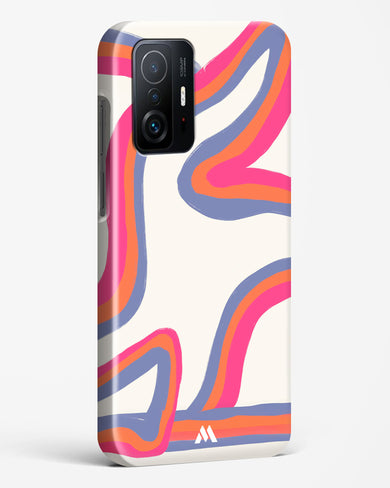 Pastel Harmony Hard Case Phone Cover (Xiaomi)