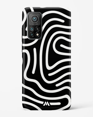 Monochrome Maze Hard Case Phone Cover (Xiaomi)