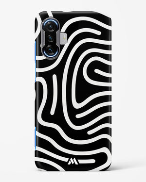 Monochrome Maze Hard Case Phone Cover (Xiaomi)