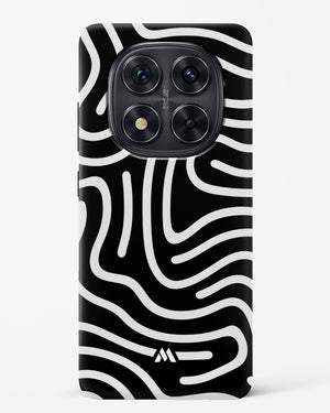 Monochrome Maze Hard Case Phone Cover (Xiaomi)
