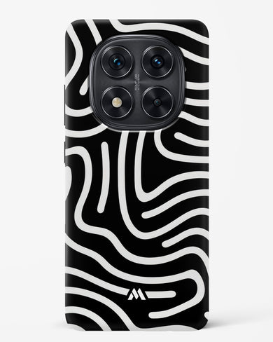 Monochrome Maze Hard Case Phone Cover (Xiaomi)