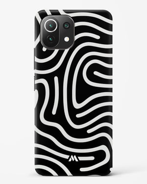 Monochrome Maze Hard Case Phone Cover-(Xiaomi)