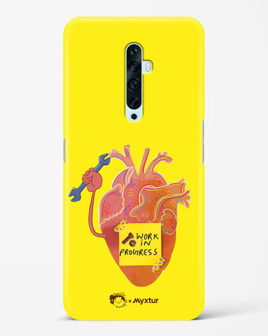 Work in Progress [doodleodrama] Hard Case Phone Cover-(Oppo)