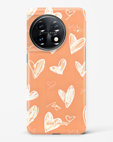 Miss You Already [BREATHE] Hard Case Phone Cover (OnePlus)