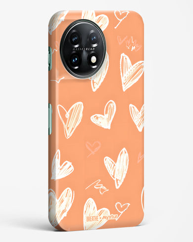 Miss You Already [BREATHE] Hard Case Phone Cover (OnePlus)
