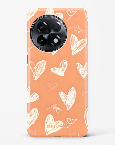 Miss You Already [BREATHE] Hard Case Phone Cover (OnePlus)